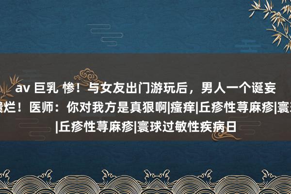 av 巨乳 惨！与女友出门游玩后，男人一个诞妄操作导致双腿溃烂！医师：你对我方是真狠啊|瘙痒|丘疹性荨麻疹|寰球过敏性疾病日